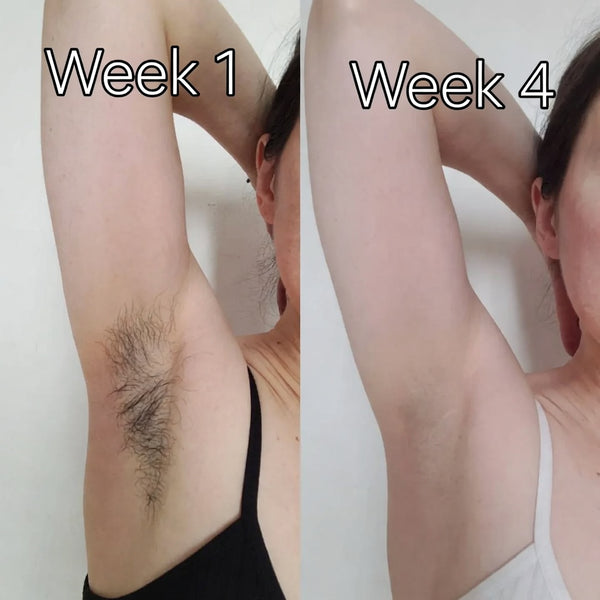Rotundus Oil for Natural Hair Reduction
